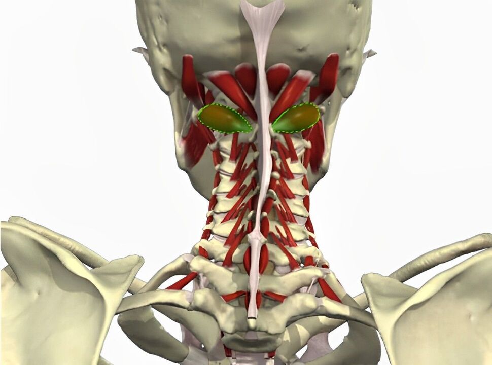 vertebrale slagader syndroom