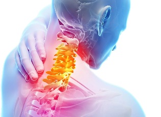 Cervicale osteochondrosis